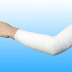 Elastikside, ühekordne (4 cm x 4 m) 20tk