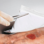 Haavapadi 20 x 40cm steriilne hea imavusega 1tk